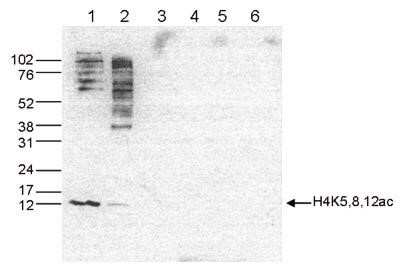 Western Blot: Histone H4 [ac Lys5, ac Lys8, ac Lys12] Antibody [NBP2-59252] - Western blot was performed on whole cell (25 ug, lane 1) and histone extracts (15 ug, lane 2) from HeLa cells, and on 1 ug of recombinant histone H2A, H2B, H3 and H4 (lane 3, 4, 5 and 6, respectively) using the antibody against H4K5,8,12ac . The antibody was diluted 1:1,000 in TBS-Tween containing 5% skimmed milk. The position of the protein of interest is indicated on the right, the marker (kDa) is shown on the left.